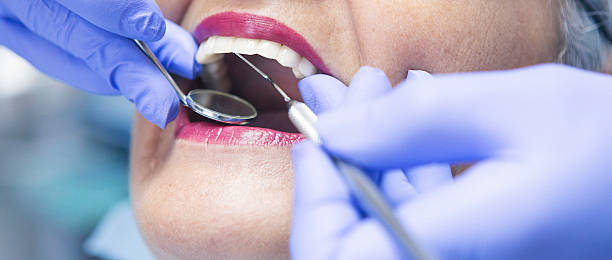 Best Emergency Wisdom Teeth Removal in Versailles, OH